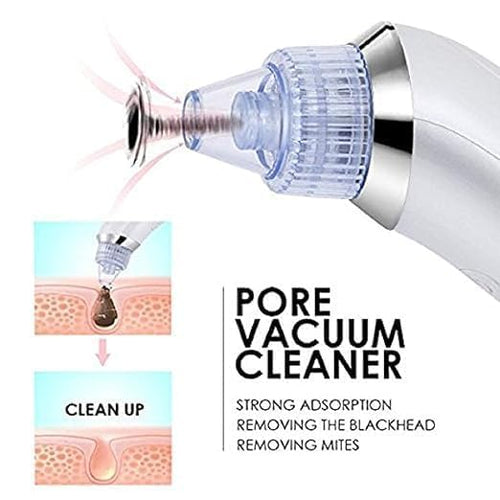 Everlasting 4 In 1 Multi-Function Blackhead Whitehead Remover Extractor Device,Skin Cleaner,Pimple Removal