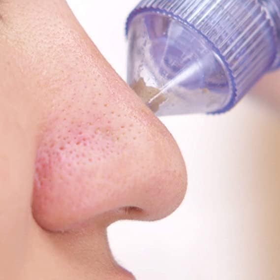 Everlasting 4 In 1 Multi-Function Blackhead Whitehead Remover Extractor Device,Skin Cleaner,Pimple Removal
