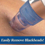 Everlasting 4 In 1 Multi-Function Blackhead Whitehead Remover Extractor Device,Skin Cleaner,Pimple Removal