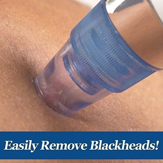 Everlasting 4 In 1 Multi-Function Blackhead Whitehead Remover Extractor Device,Skin Cleaner,Pimple Removal