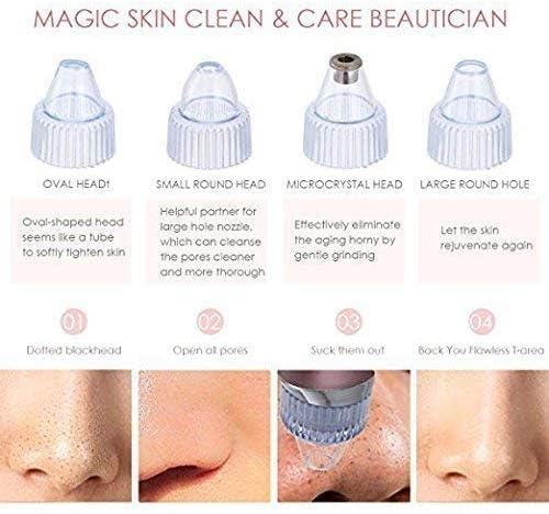 Everlasting 4 In 1 Multi-Function Blackhead Whitehead Remover Extractor Device,Skin Cleaner,Pimple Removal