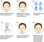Everlasting 4 In 1 Multi-Function Blackhead Whitehead Remover Extractor Device,Skin Cleaner,Pimple Removal