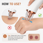 Everlasting 6 in 1 Multi-function Blackhead Remover